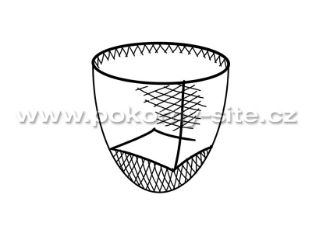 Bild von Kescher / Keschernetz, lose, maschinell hergestellt, montiert, Masche 15 mm